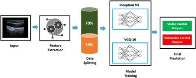 Stroke risk prediction by color Doppler ultrasound of carotid artery-based deep learning using Inception V3 and VGG-16